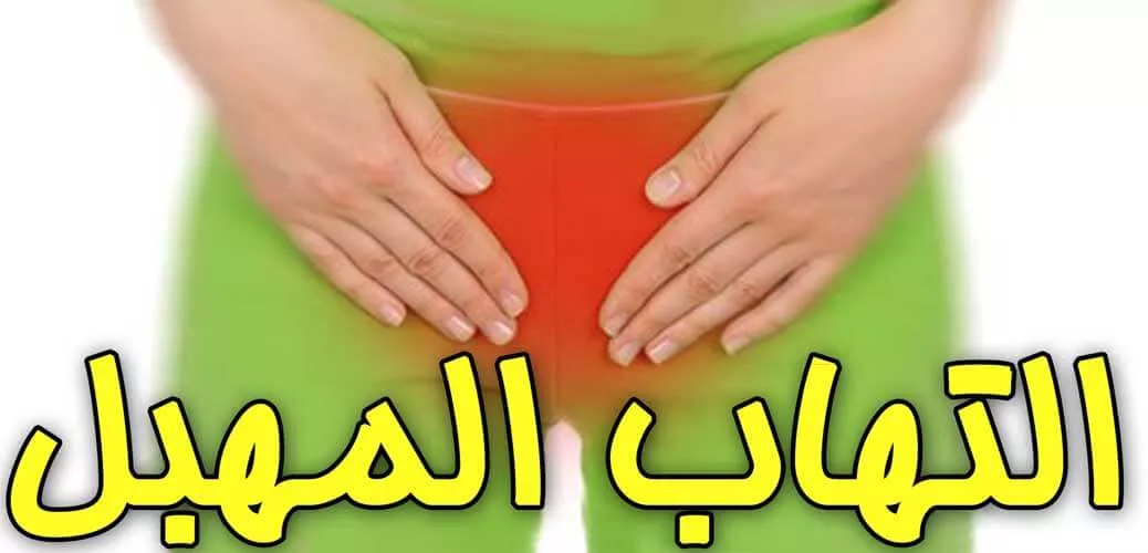 إلتهاب المهبل