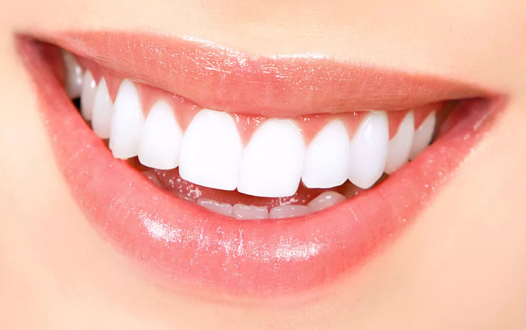 تسوس الأسنان -  5 طرق لإصلاح الأسنان بالتغذية الطبيعية