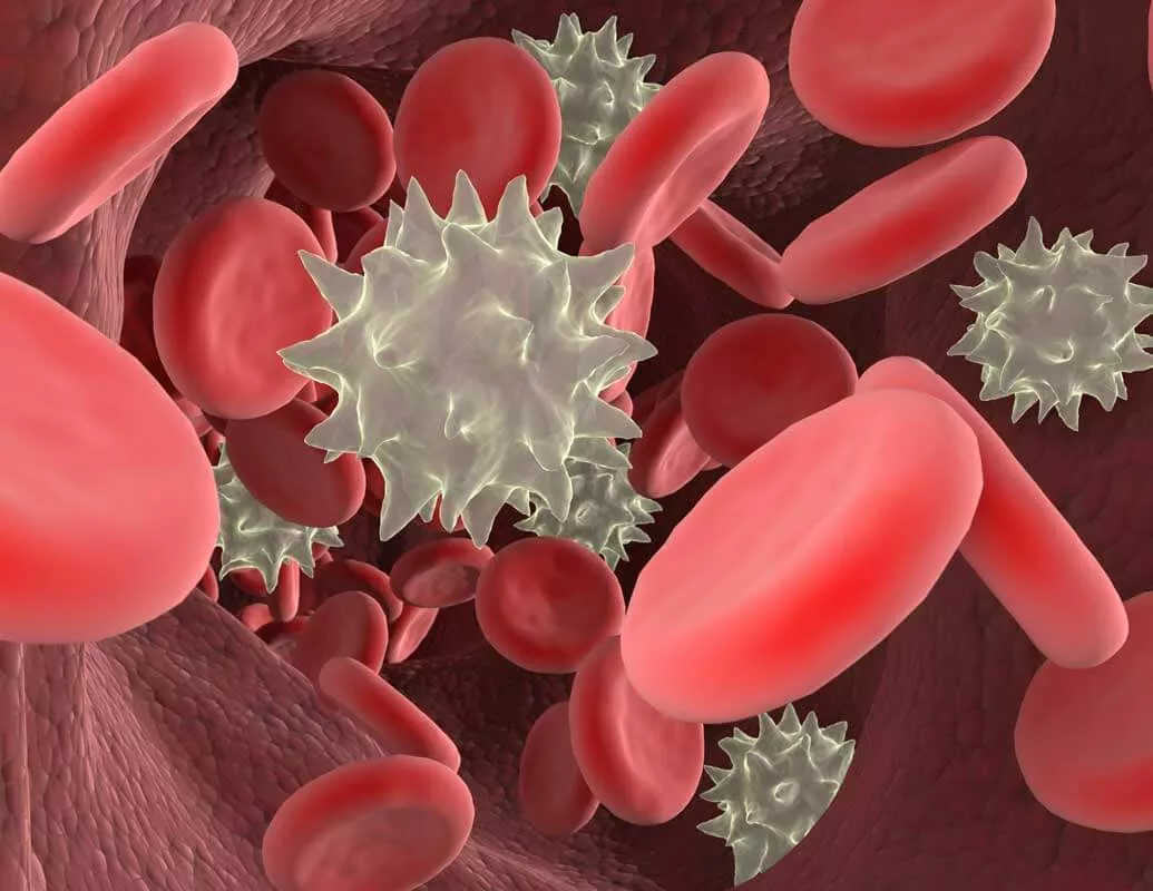 اللوكيميا (سرطان الدم ) – اسباب حدوثها والاعراض وطرق العلاج