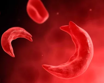 مرض فقر الدم المنجلي أو أنيميا الخلايا المنجلية