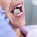 أسباب وجع الأسنان