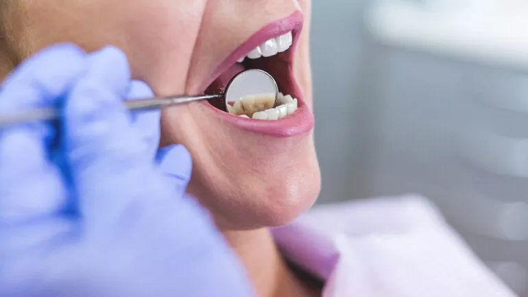 أسباب وجع الأسنان : 10 أسباب لوجع الأسنان المفاجئ