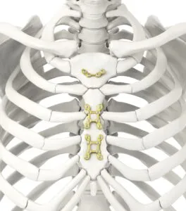 عملية القلب المفتوح 2 لوحة قصية