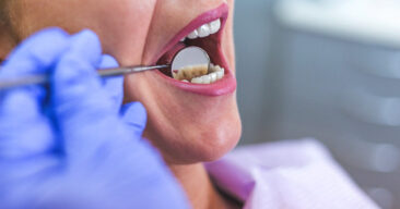 أهم 10 علاجات طبيعية لخراج الأسنان