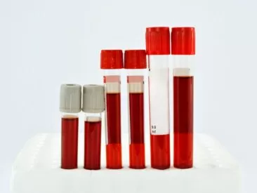 تعداد خلايا الدم الحمراء  (RBC)