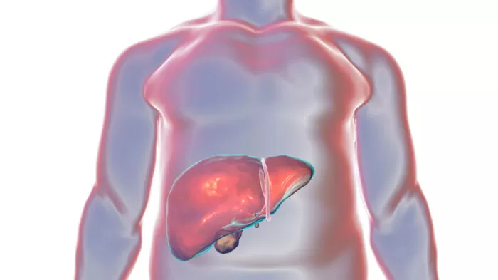 اليرقان - ما الذي يسبب بشرتي الصفراء؟ 23 مرض! 2 التهاب الكبد
