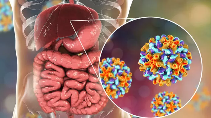 اليرقان - ما الذي يسبب بشرتي الصفراء؟ 23 مرض! 4 التهاب الكبد ب